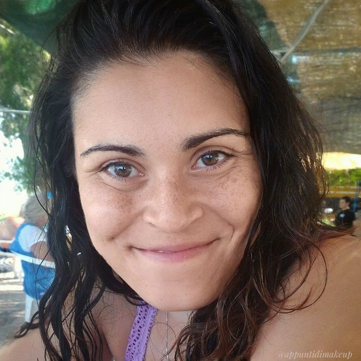 Liberarsi da perossido di lentiggini
