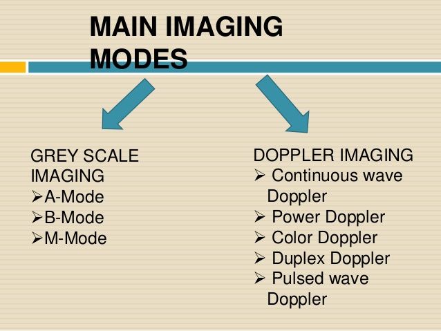 8 best SPI - ultrasound physics images on Pinterest Ultrasound - sonographer resume 8 best SPI - ultrasound physics images on Pinterest Ultrasound - sonographer resume