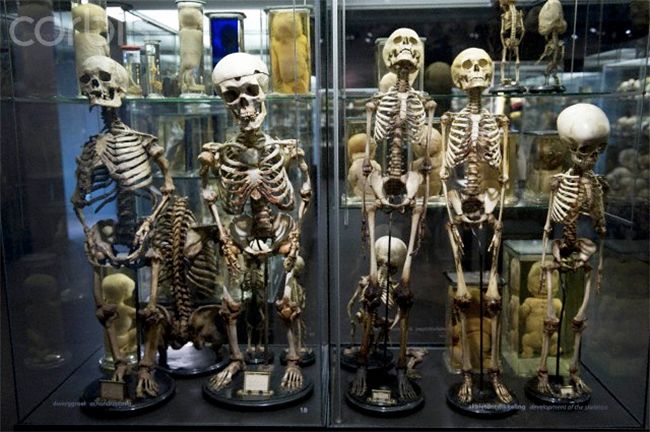 Cabinet Of Curiosities Museum Vrolik Museum Curiosity Scary