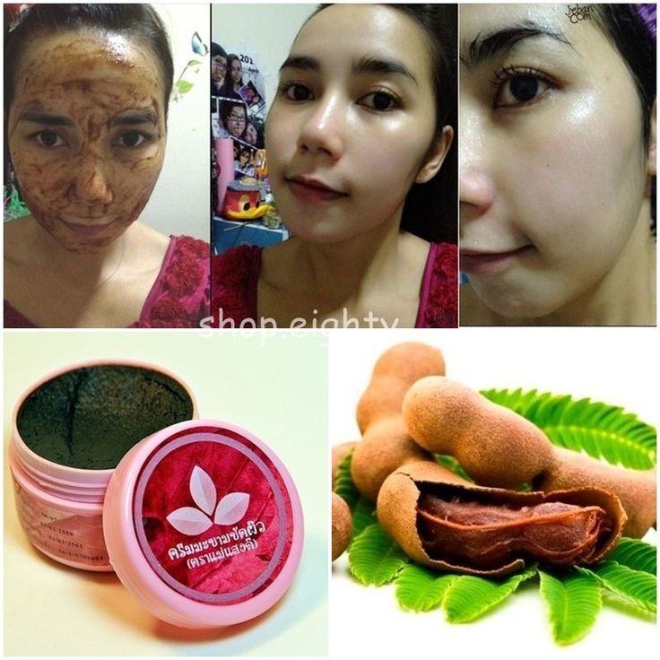 Deep facial peel — photo 13