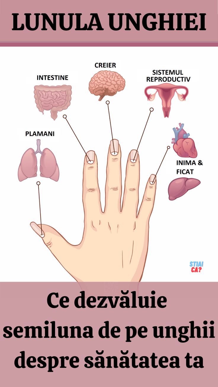 Varicoza i vase de creier. Ce s-a constatat?