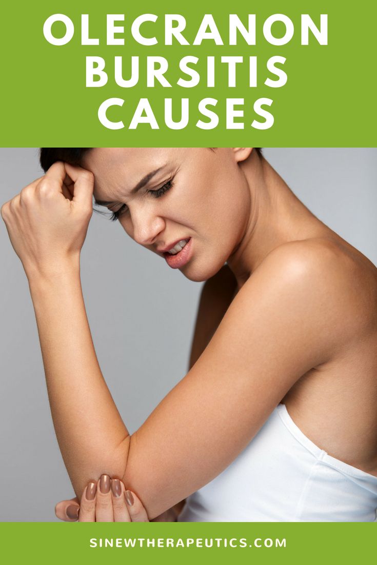 Olecranon Bursitis Natural Treatment Olecranon Bursitis Natural Treatment