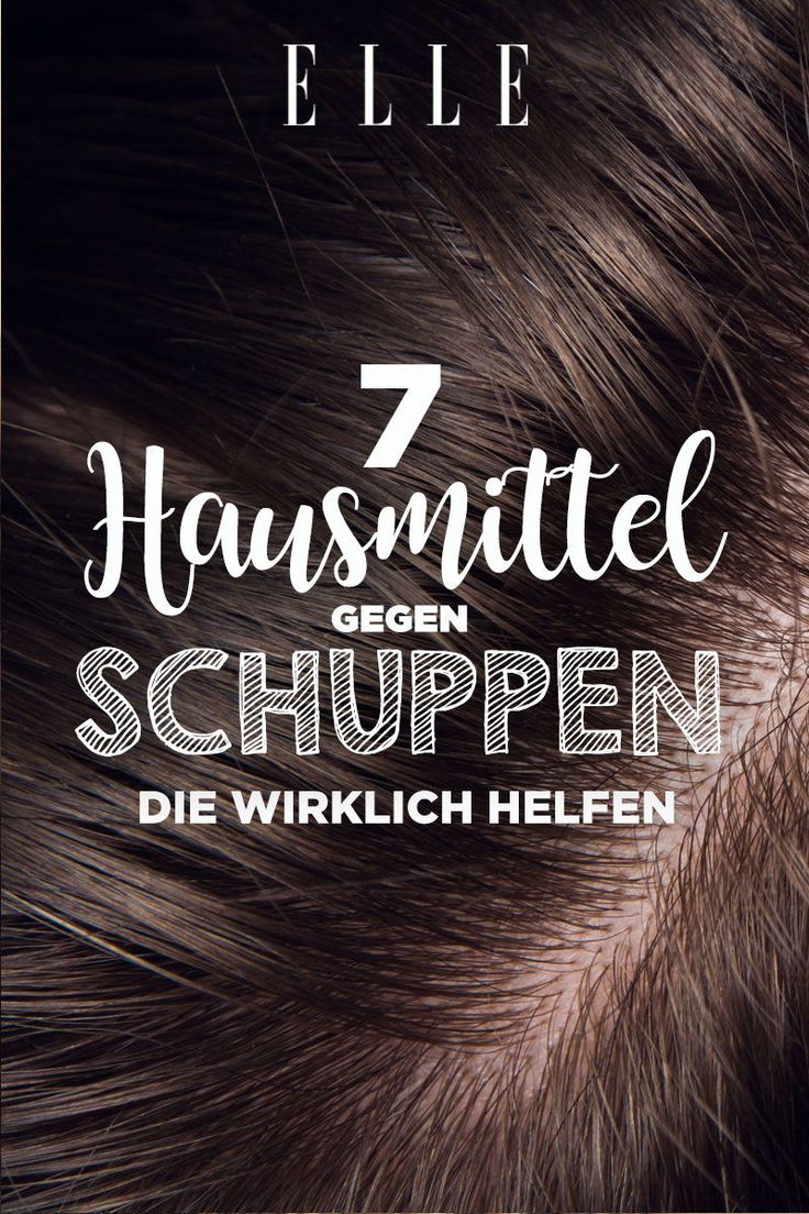 7 Hausmittel gegen Schuppen, die wirklich helfen #hausmittel #schuppen #haare #p...