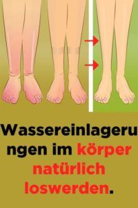 Wassereinlagerungen Im Körper Wassereinlagerungen Im Körper