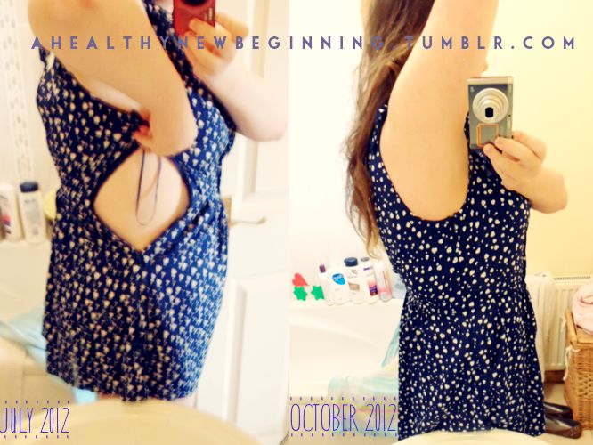 Diet To Remove Fat From Hips Diet to remove fat from hips