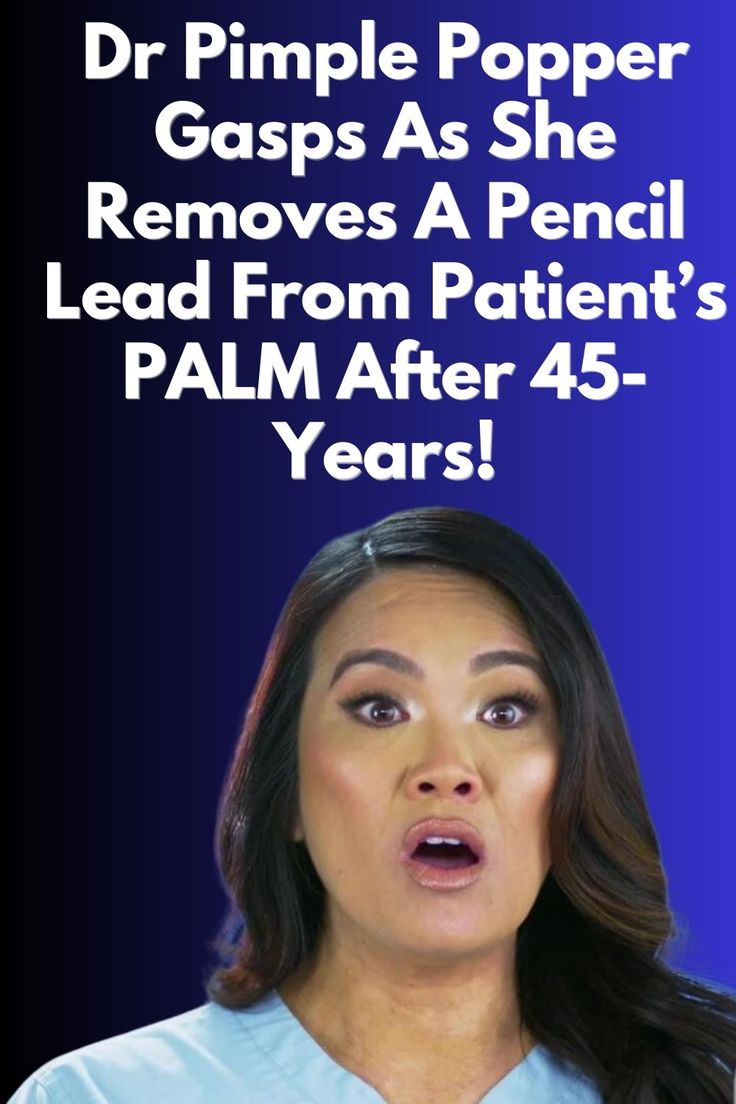 Unbelievable Dr Pimple Popper Extracts Pencil Lead Stuck In Patient s unbelievable-dr-pimple-popper-extracts-pencil-lead-stuck-in-patient-s