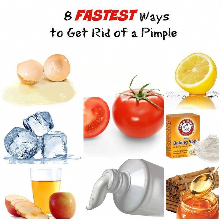 how can i treat pimples how can i treat pimples