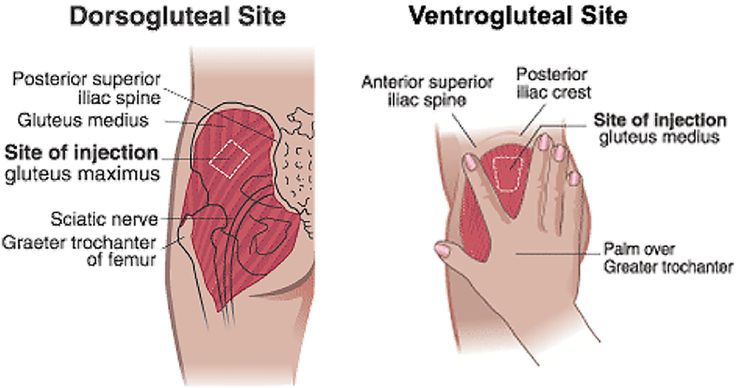Testosterone Injection Site Pain Testosterone Injection Site Pain