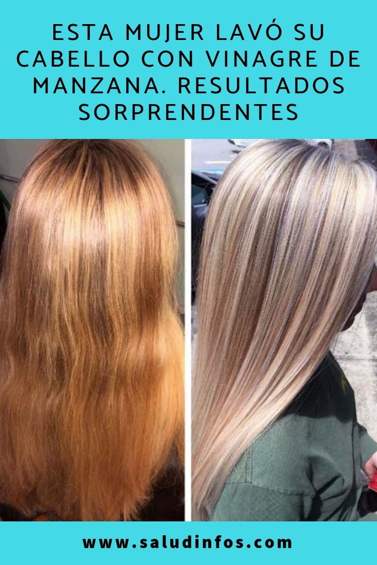 Esta Mujer Lavó Su Cabello Con Vinagre De Manzana Resultados Sorprendentes Lavó Cabello Vinagre Alopecia Long Hair Styles Hair Styles