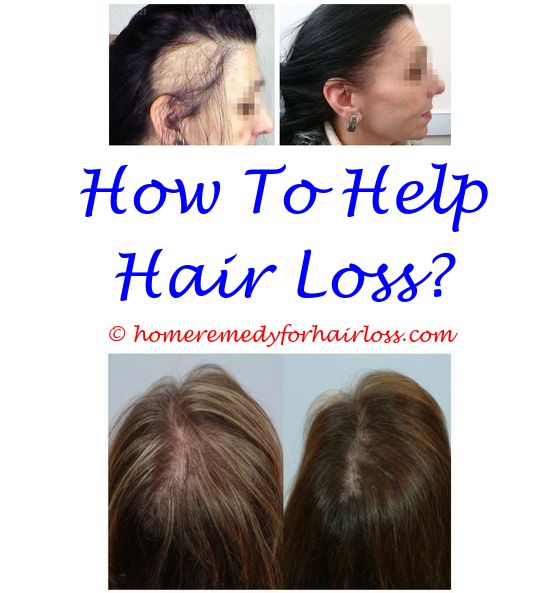 17 best Castor Oil For Hair Loss images on Pinterest | Female ...