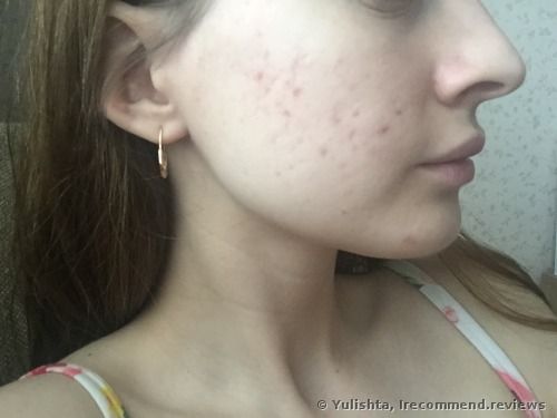 The 25+ best Avene for acne ideas on Pinterest Avene products - küchen für kinder The 25+ best Avene for acne ideas on Pinterest Avene products - küchen für kinder