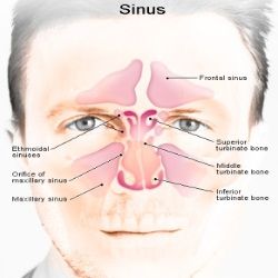 Natural Remedies For Sinus Swelling Natural Remedies For Sinus Swelling