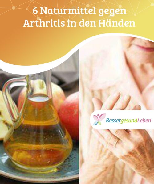 6 Naturmittel gegen Arthritis in den Händen Arthritis ist eine entzündlich ve...