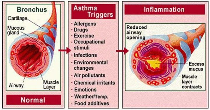 Natural Ways To Remove Carbon Dioxide From Blood Natural Ways To Remove Carbon Dioxide From Blood