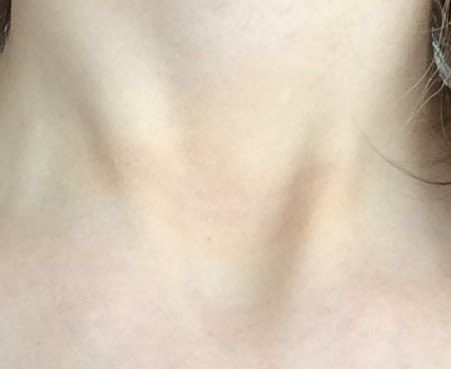 armour thyroid vs synthroid increase in synthroid dosage