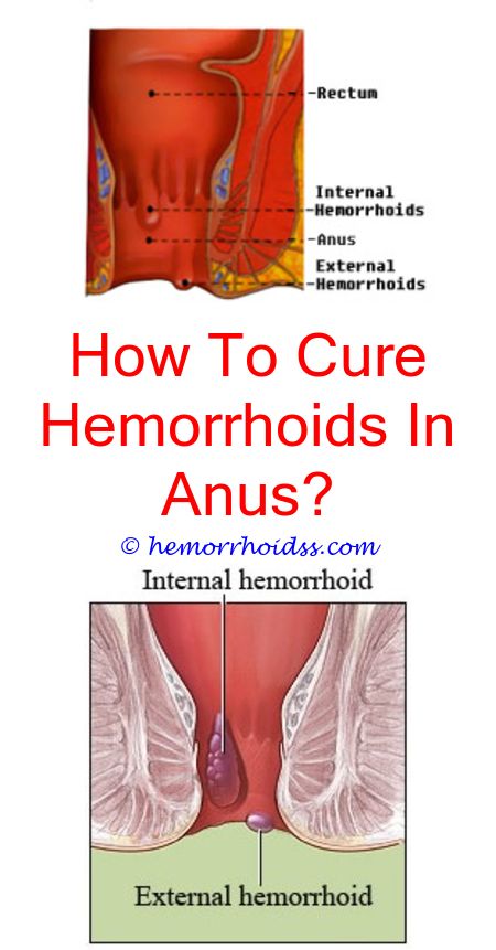 anal sex itch hemroid Mature couples homemade