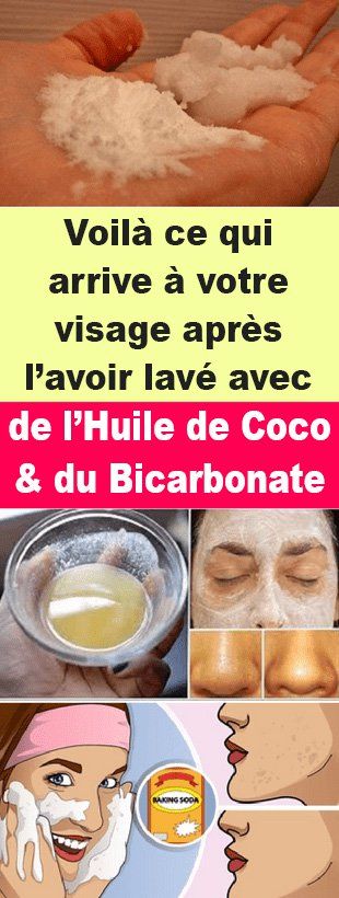 Voilà ce qui arrive à votre visage après l’avoir lavé avec de l’huile de noix de coco et du bicarbonate de soude Voilà ce qui arrive à votre visage après l’avoir lavé avec de l’huile de noix de coco et du bicarbonate de soude