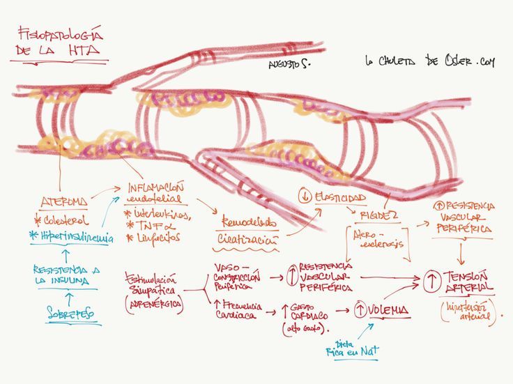 Fisiopatologia de la hta