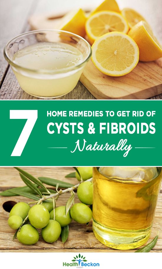How To Get Rid Of Fibroid Cysts Naturally How To Get Rid Of Fibroid Cysts Naturally