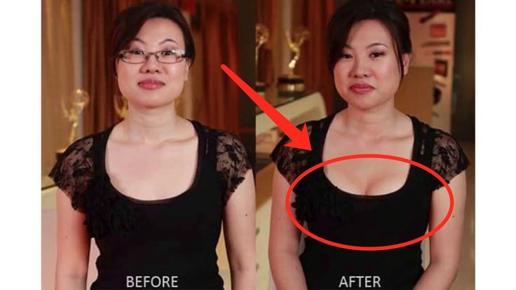 #Actives #breast #Results #Reviews #Shocking Breast Actives Reviews 2019 - NO ON...