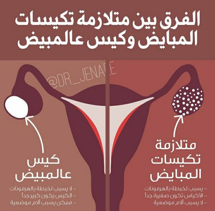 علامات تكيس المبايض الحامل منتديات الحامل Word Search Puzzle Words