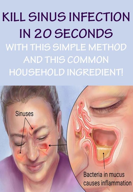 Natural Remedies For Severe Sinus Infection Natural Remedies For Severe Sinus Infection