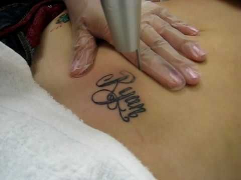 33 best home tattoo removal images on pinterest home 33 best home tattoo removal images on pinterest home
