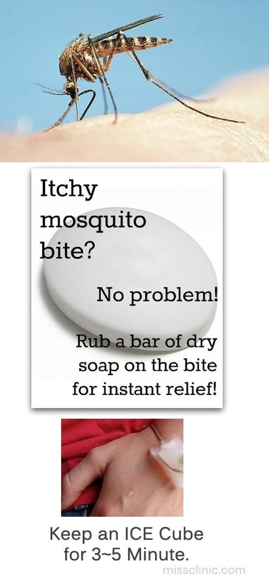 Natural Way To Stop Itching Mosquito Bites Natural Way To Stop Itching Mosquito Bites