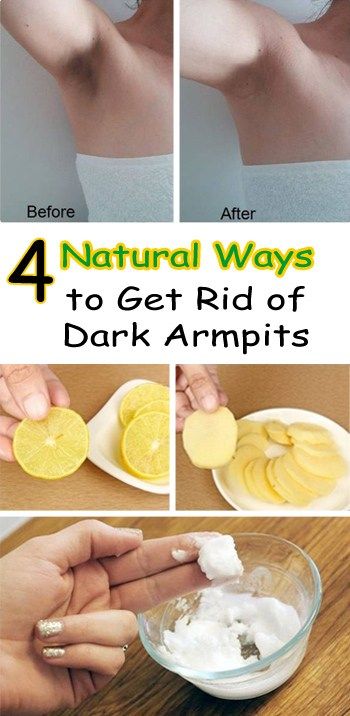 Natural Way Of Getting Rid Of Dark Spot On Body Natural Way Of Getting Rid Of Dark Spot On Body
