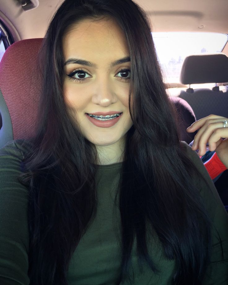 Flatten recommends best of Black pornstar with braces pornstar with braces Black