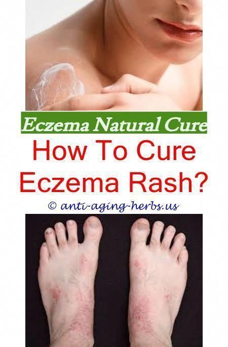 what #causes #skin #eczema #eczema #home #treatment #for #babies #- #eczema #diet #plan.eczema #skin #what #lotion #to #use #for #eczema #lecithin #eczema #eczema #sur #la #langue #images #of #eczema #on #skin #55233.infected #eczema #eczema #scrub #- #eczema #prevention.eczema #skin #rash #treatment #seacret #products #for #eczema #can #you #have #eczema #on #your #scalp #shea #moisture #eczema #and #psoriasis #therapy #lotion #review #what #to #use #for #severe #eczema #55752 # #eczemadietplans #