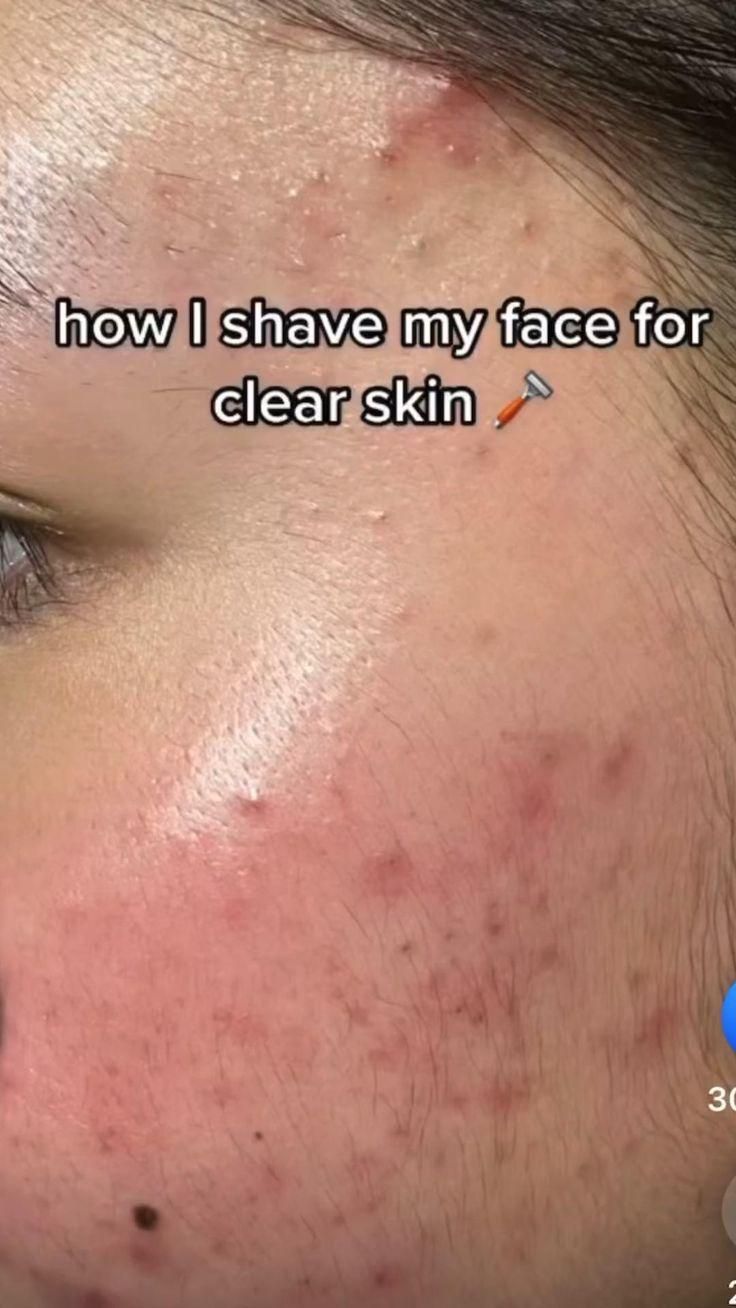 Clear Skin Tipss Video Clear Skin Tips Facial Skin Care Routine clear-skin-tipss-video-clear-skin-tips-facial-skin-care-routine