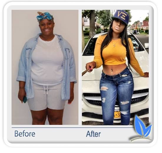 Belly fat burner belt in pakistan photo 4