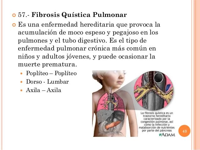 Acumulación de moco en el cerebro Acumulación de moco en el cerebro