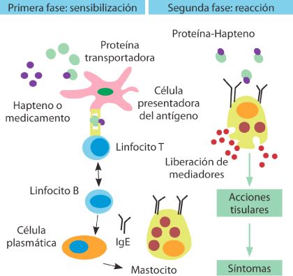 hipersensibilidad tipo 5 - Buscar con Google | informacion hipersensibilidad tipo 5 - Buscar con Google | informacion