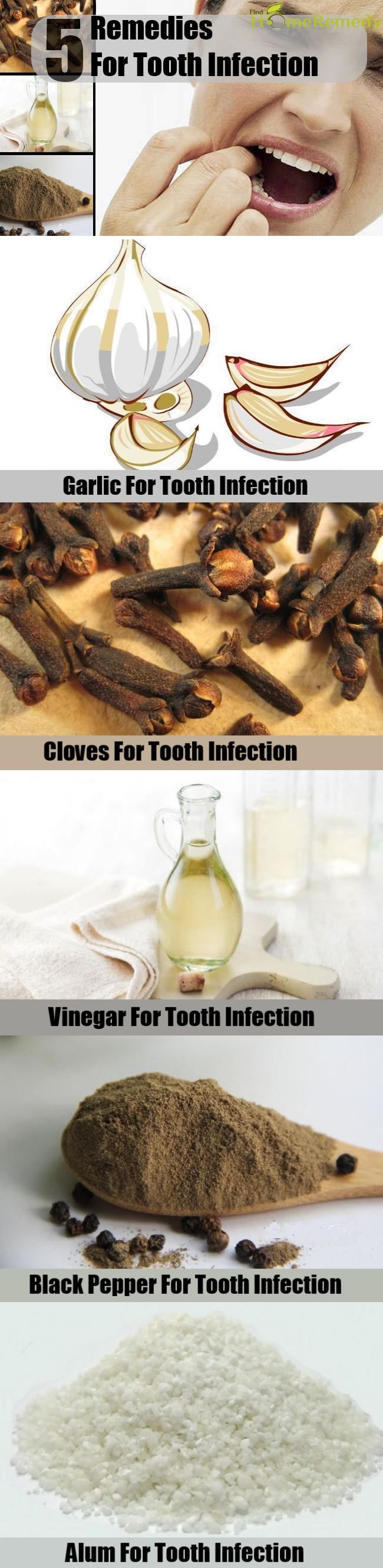 Natural Way To Get Rid Of A Tooth Infection Natural Way To Get Rid Of A Tooth Infection