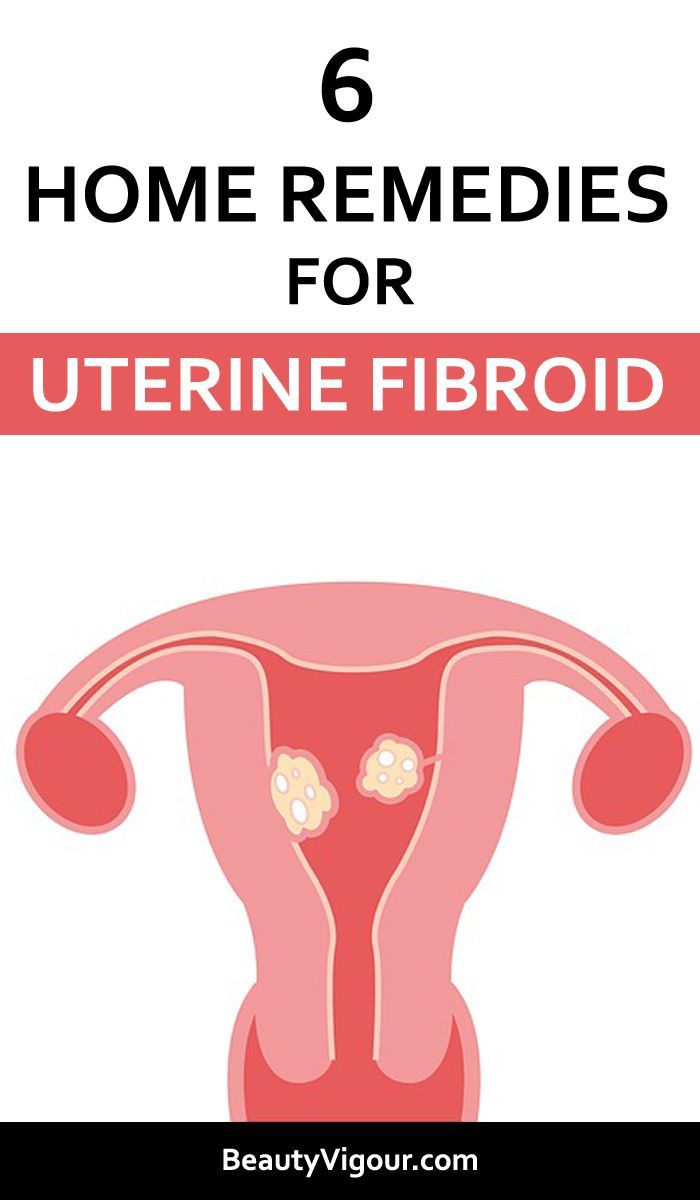 5 Foods That May Help You Shrink Fibroids 247 Best Sellers Reviews Fibroids Fibroids Shrink Fibroids Treatment