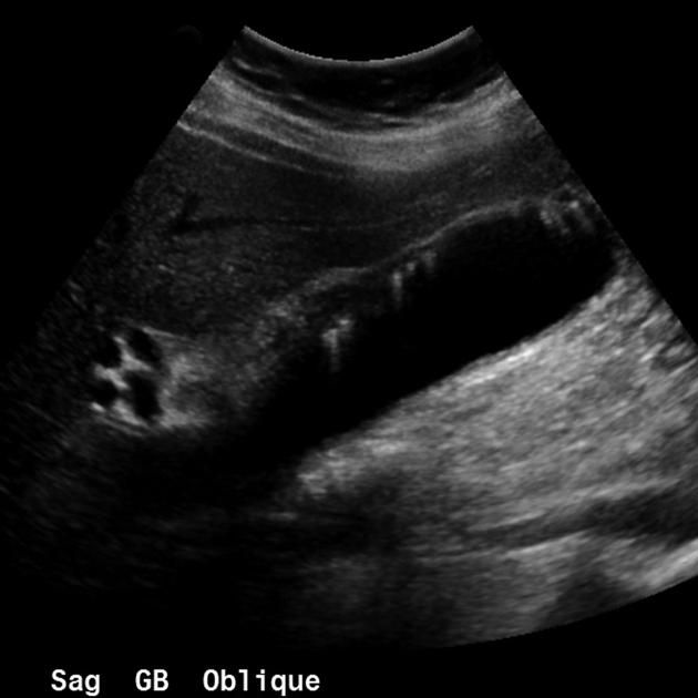 79 best Sonography images on Pinterest Career, Carrera and - ultrasound student resume 79 best Sonography images on Pinterest Career, Carrera and - ultrasound student resume