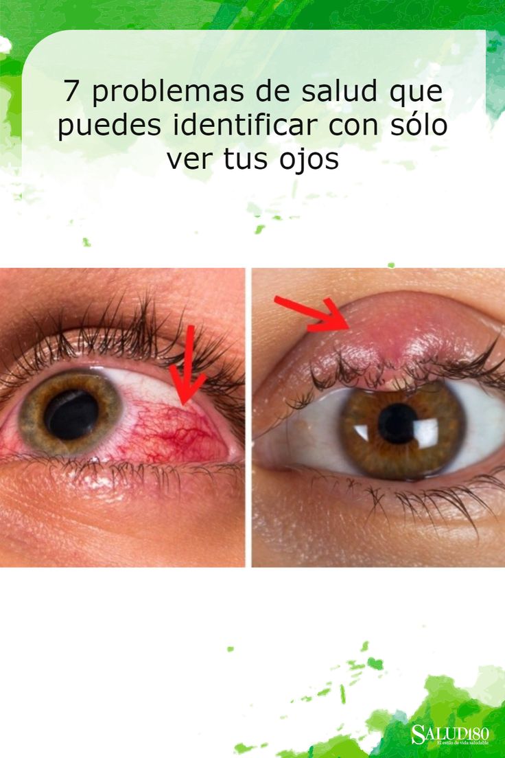 Pin En Patrones