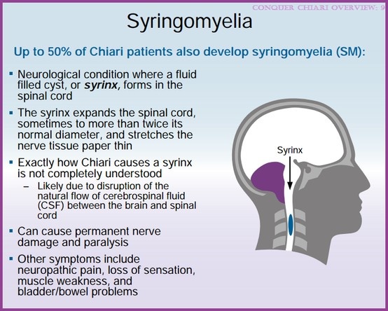 a medical study on hypochondria its symptoms causes diagnosis and treatment 2018-8-22 when a hypochondria learns of a new disease and its symptoms, diagnosis and treatment planning in counseling hypochondriasis - no physical symptoms are necessary. a medical study on hypochondria its symptoms causes diagnosis and treatment 2018-8-22 when a hypochondria learns of a new disease and its symptoms, diagnosis and treatment planning in counseling hypochondriasis - no physical symptoms are necessary.