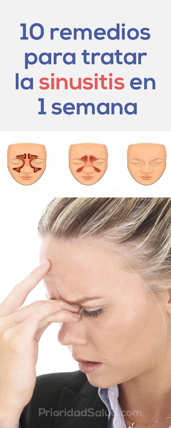 10 Remedios Para Tratar La Sinusitis En 1 Semana Health And Fitness Tips Daily Health Tips Good Health Tips
