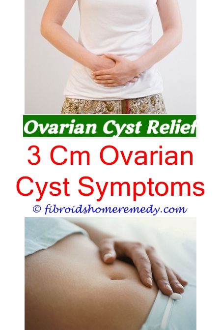 ovarian cyst