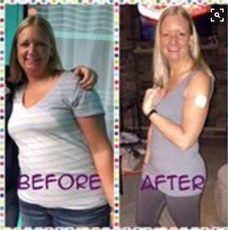 Diet plan for bone healing picture 4