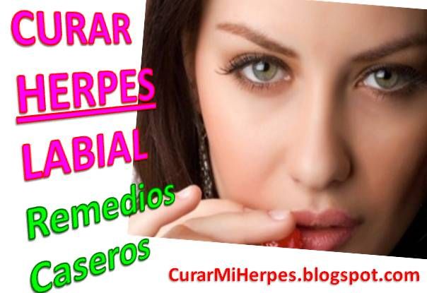 Como curar herpes labial