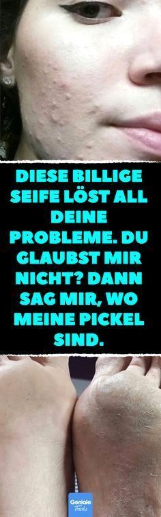 Diese billige Seife löst all deine Probleme. Du glaubst mir nicht? Dann sag mir...