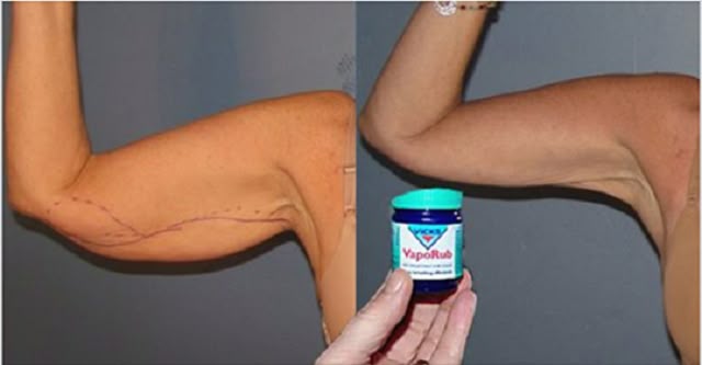 Eliminare il tartaro dai denti in modo naturale - Vivere ...