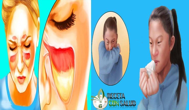 La mejor medicina para el resfriado común