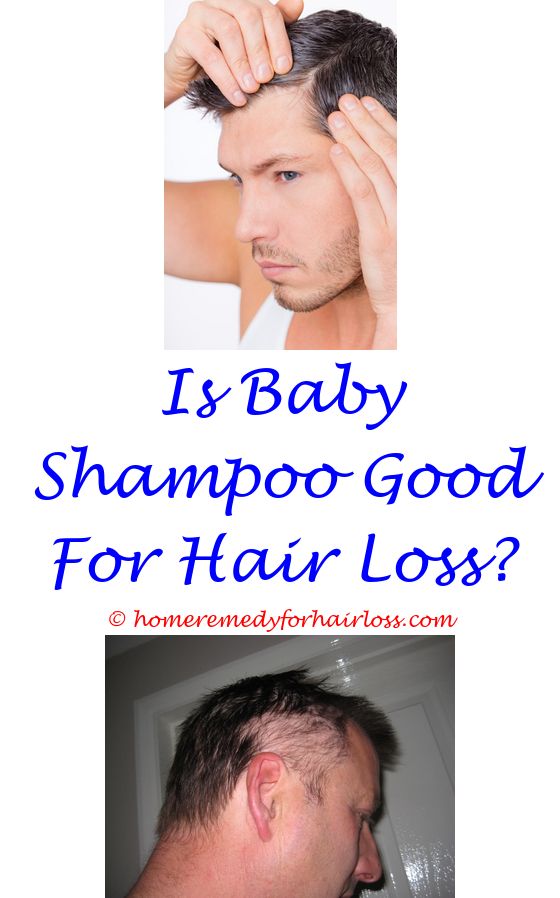 14 best Hair Loss Cure 14 images on Pinterest | Hair loss help ...