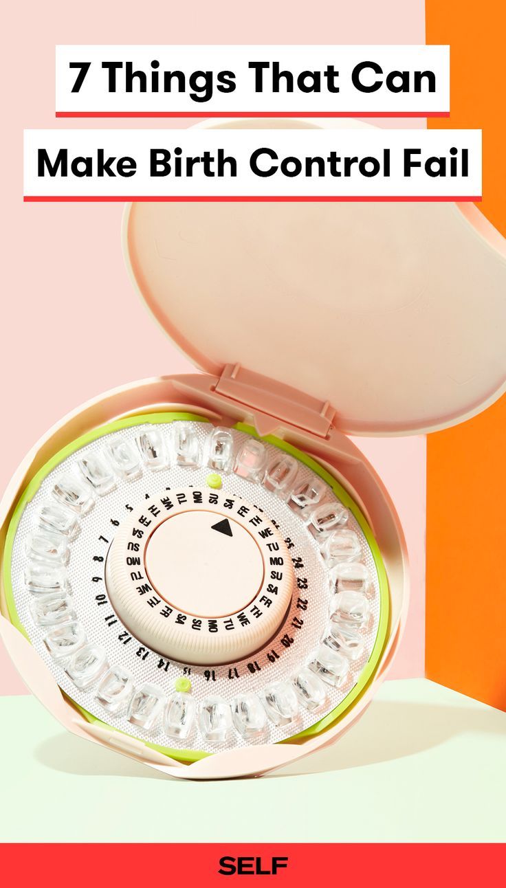 Best option for permanent birth control