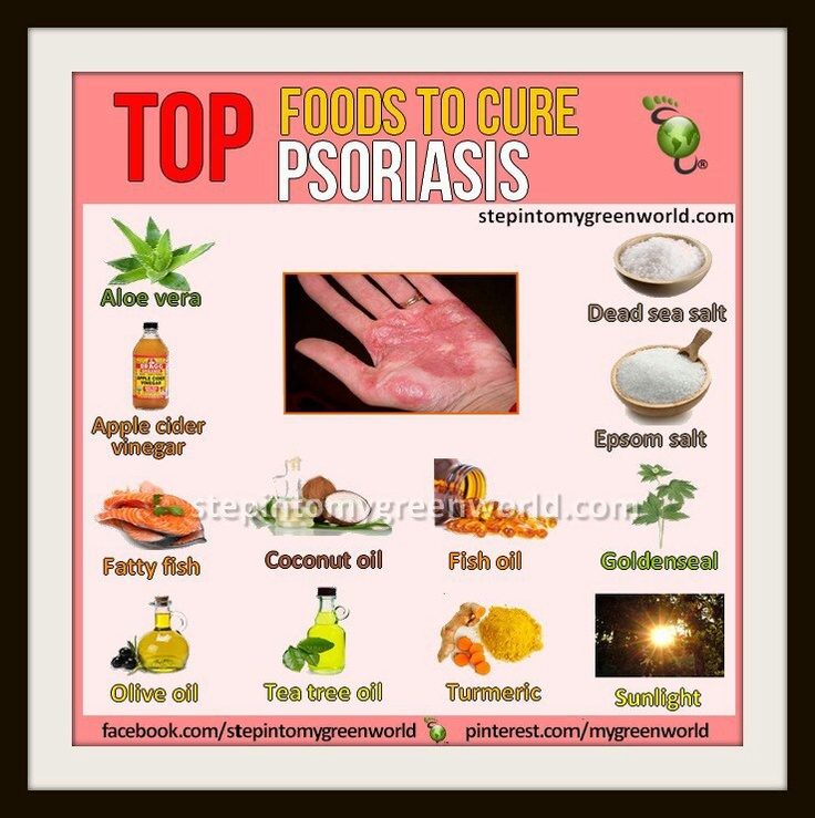 Psoriasis Foods Not To Eat Psoriasis Foods Not To Eat
